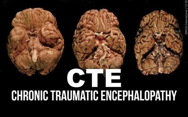 IT’S TIME TO REDEFINE CTE