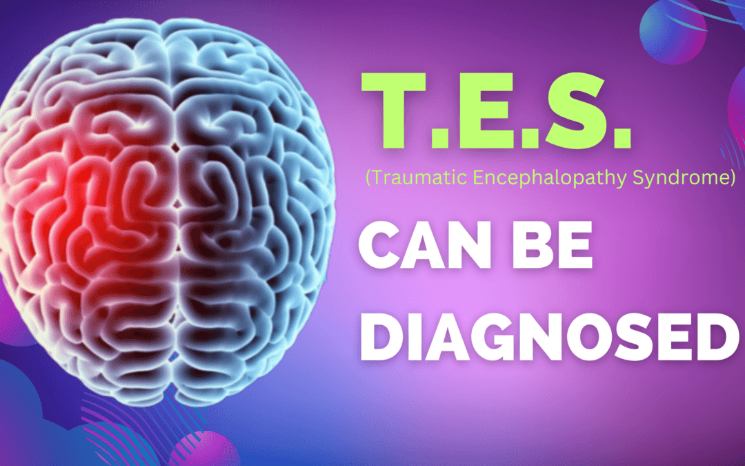 TES CAN be Diagnosed